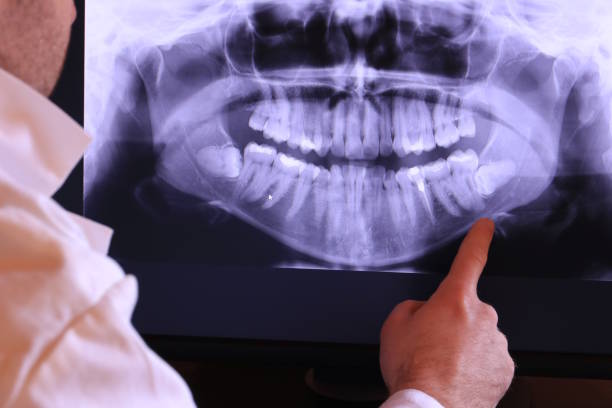 Best Emergency Dental Filling Replacement  in Bethel Manor, VA