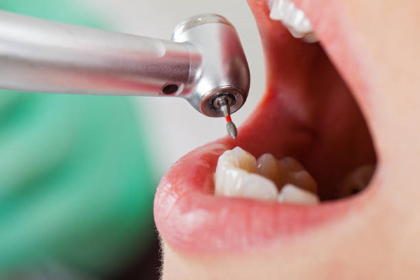 Best Emergency Tooth Extraction  in Bethel Manor, VA